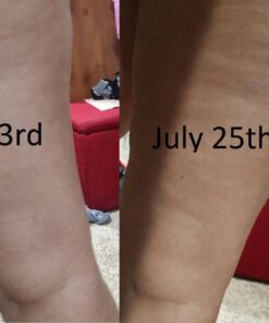 Scala Silicone Anti Cellulite Massager, Body Shower Scrubber, Cellulite Remover - Improve Circulation, Distribute Fat Deposits, Body Massager, Exfoliator, Fat Roller Use with Creams and Oils - Pink A. Pink 30 61k8YmMdL