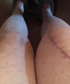 Penetrex Joint & Muscle Therapy – Soothing Relief for Back, Neck, Hands, Feet & Nerves – Maximum Strength Premium Whole Body Recovery Rub with Arnica, Vitamin B6 MSM & Boswellia – Non-Greasy 2oz Cream 2 Ounce (Pack of 1) 25 61kNthCYImL