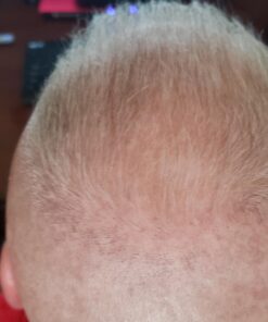 Growth Treatment Unscented 5% (Foam) 2 Ounce (Pack of 1) 16 61kZUO4YFL