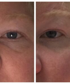 Pure Body Naturals Retinol Moisturizer, 1.7 Ounces - Moisturizing Retinol Cream for Face, Age Defying Eye Cream for Wrinkles and Lines with Hyaluronic Acid, Shea Butter, and Jojoba Oil 34 61khZ6gOtxL