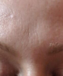 Glycolic Acid 50% Gel Peel with Chamomile and Green Tea Extracts - Professional Grade Chemical Face Peel for Acne Blemishes, Collagen Boost, Wrinkles, Fine Lines - Alpha Hydroxy Acid - 1 Bottle of 1 fl oz 30 61l85Ay3TfL