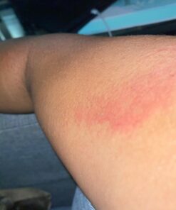 Terrasil Skin Repair Cream MAX, Natural Ingredients, Zinc Oxide Ointment for Folliculitis and Boil Symptoms, All Purpose First Aid Supplies, Anti Itch Cream, 50g 16 61lB9r0KyAL