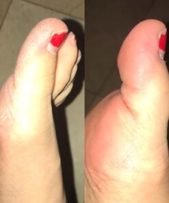 Amope Pedi Perfect Electronic Foot File, Dual-Speed Callus Remover (with Diamond Crystals) for Feet (Extra Coarse - Pink Gadget). -Perfect for In-home Pedicure for Baby Smooth Feet. Battery Operated 36 61lLwxN2ePL