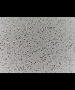 YO Home Sperm Test | at-Home Fertility Test Kit for Men | Check Motile Sperm Concentration with 97% Accuracy | Fast Results Using Your Smartphone | Includes 2 Tests | Private, Convenient, Easy to Use 27 61lhwsSGCaL