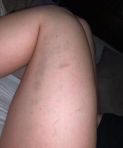 Coolife Fascia Muscle Roller - Cellulite Massager - Fascia Roller for Cellulite and Sore Muscles - Neck, Leg, Back, Body Roller Deep Tissue Massage Stick Tools - 3 Balls Size Version. Mint Green 38 61litmJc0JL