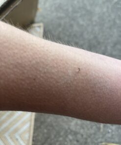 Wondercide - Ready to Use Flea, Tick, Yard Spray with Natural Essential Oils – Mosquito and Insect Killer, Treatment, and Repellent - Plant-Based - Safe Around Pets, Plants, Kids - 32 oz 20 61mPHJZjOL