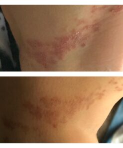 Moisturising Cream, Body and Face Moisturizer for Dry Skin, Acne Cream, 2PC 0.53 Ounce (Pack of 1) 50 61nDP6mcgdL