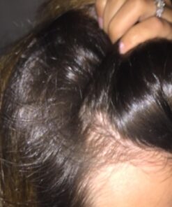 Head and Shoulders Clinical Strength Dandruff and Seborrheic Dermatitis Shamp 13.5 Fl Oz(Pack of 2) 23 61naBAocOJL