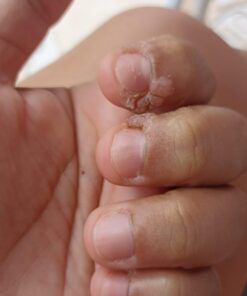 Dr. Scholl's Dual Action Freeze Away WART Remover, 8 Applications // Freeze Therapy + Powerful Fast Acting Salicylic Liquid to Remove Common and Plantar Warts, 0.33 Fl Oz, 1 Count 46 61nr3 ZBlL