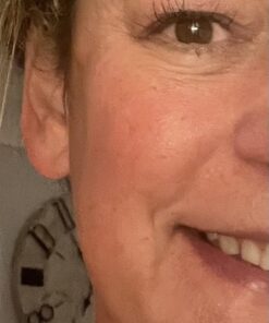 Solawave 4-in-1 Radiant Renewal Wand and Serum Bundle, Face Skincare Wand with Facial Massager, Facial Wand with Renew Complex Serum Blue/Pink Ombre 26 61o2o9nuzBL