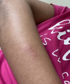 Sallye Ander "No-Bite-Me" All Natural Bug Repellent & Insect Repellent - Anti Itch Cream - Safe for Kids and Infants - Repels Mosquitoes, Fleas, and Ticks - 2 oz - Organic Bug Repellent for Skin 2 Ounce (Pack of 1) 52 61oSjr3RYL