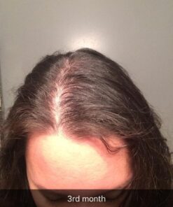 Newopure: Natural Hair Growth Vitamins, Repairs Hair Follicles, Stops Hair Loss, Blocks DHT, Stimulates New Hair Growth, Promotes Thicker, Fuller and Faster Growing Hair. Men & Women (30 Day Supply) 25 61osmrMsh7L