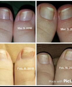 3 in 1 Professional Foot Spa Kit-with Tea Tree Foot & Body Soak-Tea Tree Body Wash & Nail Blend-Soothes Dry, Burning & Itchy Skin-Refreshes Unwanted Foot Odor-Restores Unhealthy Nails-Purely Northwest Tea Tree Oil 3 Piece Set 35 61pFPzHKRUL 1