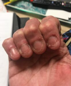 DAILY REMEDY Tea Tree Oil Extra Strength Super Balm - Athletes Foot Cream Combats Ringworm, Jock Itch, Nail Issues - Nourishes Cracked Itchy Skin on Body & Feet - Made in USA 2 Ounce (Pack of 1) 30 61pWE5x7OQL 3