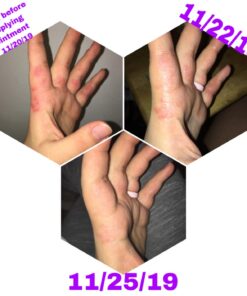 Moisturising Cream, Body and Face Moisturizer for Dry Skin, Acne Cream, 2PC 0.53 Ounce (Pack of 1) 37 61rK7jx8URL