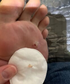 Dr. Scholl's Dual Action Freeze Away WART Remover, 8 Applications // Freeze Therapy + Powerful Fast Acting Salicylic Liquid to Remove Common and Plantar Warts, 0.33 Fl Oz, 1 Count 51 61sF 92IoL