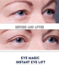 Eye Magic Original Eye Lift Kit (Small/Medium Size With Gel) Lifts Eyelid Droop and Hooded Eyes | Open And Show Off Your Beautiful Eyes | Made In America 16 61sSWk9XI0L