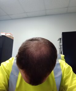 PRN Pure Results Nutrition DasGro Hair Growth Vitamins, Biotin & DHT Blocker, Stops Hair Loss, Thinning, Balding, Promotes Hair Regrowth in Men & Women, All Hair Types, 30 Day Supply 28 61snkQxu5L 1