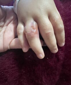 SilverSeal Burn and Wound Dressing | Hydrogel Pads with X-Static Silver | Soothing, Moist & Protective | Burns, Cuts & Wounds | 4 Sterile Dressings 4"x4" Patch (4 Count) 53 61t2P0icyjL