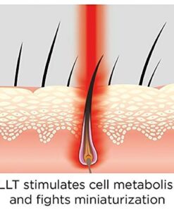 iRestore Essential Laser Hair Growth System - FDA Cleared Hair Loss Treatments for Men & Women & Hair Growth Products for Men with Thinning Hair, Hair Regrowth Treatments Laser Cap, Red Light Therapy 34 61tFuNQX L