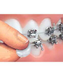 Genuine Orthowax - Orthodontic Wax for Braces Wearer - Stick Better Than competitors 9 21 61tTo0haE4L