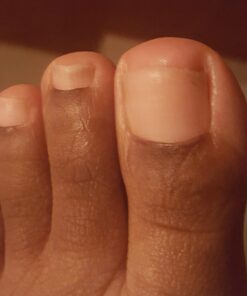 PURELY NORTHWEST-Tea Tree Oil & Peppermint Foot Soak with Epsom Salt-for Stubborn Foot Odor, Athletes Foot Burning & Itching, Damaged Discolored Nails-A Natural Callus Remover 16 Ounces 1 Pound (Pack of 1) 41 61u2yN24eFL