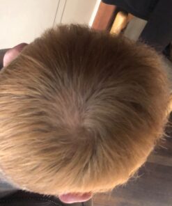 Men's Rogaine 5% Minoxidil Foam for Hair Loss and Hair Regrowth, Topical Treatment for Thinning Hair, 3-Month Supply, 2.11 Ounce (Pack of 3) Men's Rogaine Foam Treatment (3-Month Supply) 2.11 Ounce (Pack of 3) 50 61uQfGJlIL