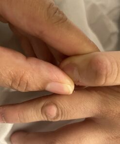 Compound W One Step Wart Remover Strips for Kids, 10 Medicated Strips for Wart Removal, 2 Pack unflavored 10 Count (Pack of 2) 39 61vRuU2mL