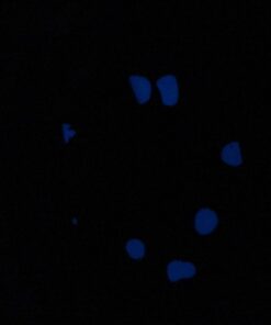 Opps 100 Pcs Glow in The Dark Garden Pebbles for Walkways and Decor in Blue 25 61w45cecpAL