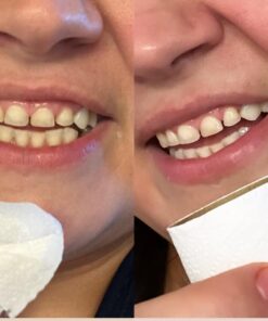 Opalescence 35% Gel Syringes Teeth Whitening - Refill Kit (2 Packs / 4 Count) Carbamide Peroxide. Made by Ultradent, in Cool Mint Flavor. Tooth Whitening Refill Syringes 5197-2 Mint 35 4 Count (Pack of 1) 27 61wEkjmxuIL