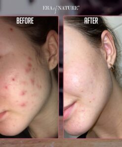 era of nature Best Raw ORGANIC AFRICAN BLACK SOAP, for Dry Skin and Skin Conditions. Pure & Natural Ingredients, Imported From Ghana - 1lb (16oz) 26 61wL33PenEL