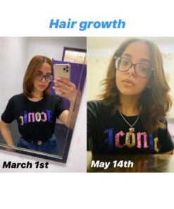 Artnaturals Biotin Gummies for Hair Growth - (100 Gummies - 10000mcg) - Natural Strawberry Vitamins Supports Nails and Skin - Gelatin, Gluten, Nut and Egg Free 22 61whVFbPEXL