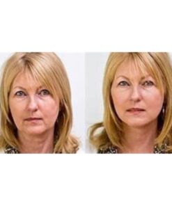 Art Harding's Instant Face & Neck Lift (Dark) - Chemical-Free, Hypoallergenic, for All Skin Types Dark 14 61xN3KtGN0L