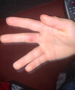 Compound W One Step Wart Remover Strips for Kids, 10 Medicated Strips for Wart Removal, 2 Pack unflavored 10 Count (Pack of 2) 48 61yEntHH9L