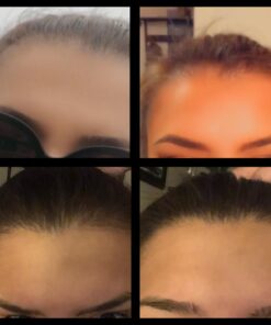 iRestore Essential Laser Hair Growth System - FDA Cleared Hair Loss Treatments for Men & Women & Hair Growth Products for Men with Thinning Hair, Hair Regrowth Treatments Laser Cap, Red Light Therapy 52 61z 0sqR8zL