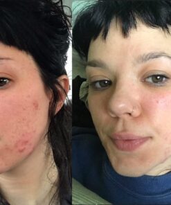 Living Libations - Organic Best Skin Ever All-In-One Facial Cleanser, Exfoliator + Moisturizer | Natural, Wildcrafted, Vegan Clean Beauty (Seabuckthorn, 1.69 oz | 50 ml) 1.69 Fl Oz (Pack of 1) 10 61z5wWxS4GL