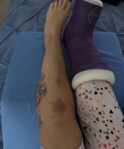 DMI Ortho Bed Wedge Elevated Leg Pillow, Supportive Foam Wedge Pillow for Elevating Legs, Improved Circulataion, Reducing Back Pain, Post Surgery and Injury, Recovery, Blue 8" x 20" x 24" 8 Inch 36 61z8yDDEYML