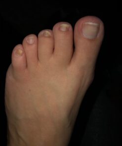 PURELY NORTHWEST-Tea Tree Oil & Peppermint Foot Soak with Epsom Salt-for Stubborn Foot Odor, Athletes Foot Burning & Itching, Damaged Discolored Nails-A Natural Callus Remover 16 Ounces 1 Pound (Pack of 1) 40 61z9I6goYfL