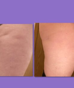 WeightLoss-Solutions Thigh Trimmer Sweat Wrap Sauna Belts to Reduce Cellulite, Thigh Fat, and Jiggly Arm Fat. Increase Heat, Sweat, and Circulation to Burn Fat, Smooth, Firm and Tone Black 21 61zZtQaCWtL 1