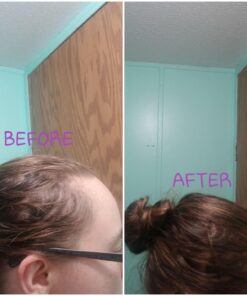 XFusion Keratin Hair Fibers - Black (Large Size 28g) Medium Brown 36 71 3gMYfvRL