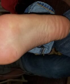 Compound W Freeze Off Plantar Wart Remover Kit, 8 Applications,1 Count (Pack of 1) Unflavored 21 71 9wMOU9OL