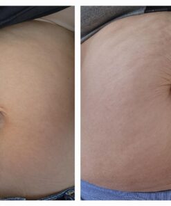 Nivea Skin Firming and Toning Body Gel Cream with Q10, Firming Body Cream, Moisturizing Skin Cream, 6.7 Oz Tube Skin Firming Gel 45 71 Bazz2TuL