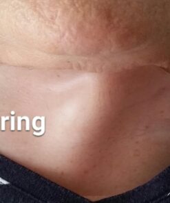 Silc Skin Collette Pad to Help with Neck & Collarbone Wrinkles from Sun, Aging, Side Sleeping, Reusable Self Adhesive Medical Grade Silicone, 1 Pad 11 71 DEJNgjBL