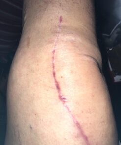 Penetrex Joint & Muscle Therapy – Soothing Relief for Back, Neck, Hands, Feet & Nerves – Maximum Strength Premium Whole Body Recovery Rub with Arnica, Vitamin B6 MSM & Boswellia – Non-Greasy 2oz Cream 2 Ounce (Pack of 1) 26 71 eurAtIiL