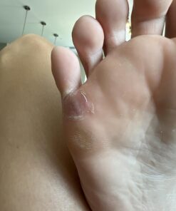 Compound W Maximum Strength One Step Plantar Wart Remover Foot Pads, 20 Count 20 Count (Pack of 1) 44 71 nFF07feL