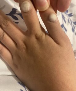 Compound W One Step Wart Remover Strips for Kids, 10 Medicated Strips for Wart Removal, 2 Pack unflavored 10 Count (Pack of 2) 40 7108dpD5RyL