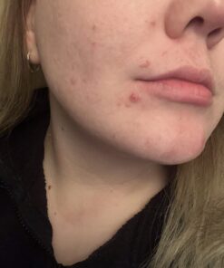 Terrasil Wound Care - 3X Faster Healing, Infection Protection Ointment for bed sores, pressure sores, diabetic wounds, ulcers, cuts, scrapes, and burns (14 gram tube) 43 7109kkrET9L