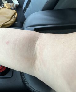 Tea Tree Oil Balm , Extra Strength, Pair Well with Jock Itch Cream, Spray, Athletes Foot, Ringworm Cream for Human, Fast Acting for Dry, Itchy Skin, Plant Powered Wonder Balm 42 710IjQha5GL