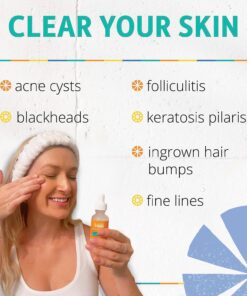 Face & Body Clearing Serum, Level 1- for acne, folliculitis, aging skin, ingrown hairs, dark spots - face, chest, butt, back, thighs, arms - mandelic acid - 1 fl oz 1 Fl Oz (Pack of 1) 22 710OIG0XvFL