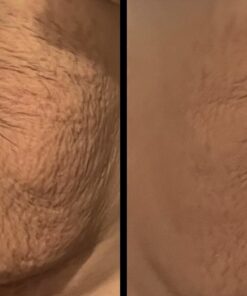 Glycolic Acid 30% Gel Peel with Chamomile and Green Tea Extracts - Professional Grade Chemical Face Peel for Acne Scars, Collagen Boost, Wrinkles, Fine Lines - Alpha Hydroxy Acid - 1 Bottle of 1 fl oz 1 Fl Oz (Pack of 1) 31 710qXya18kL